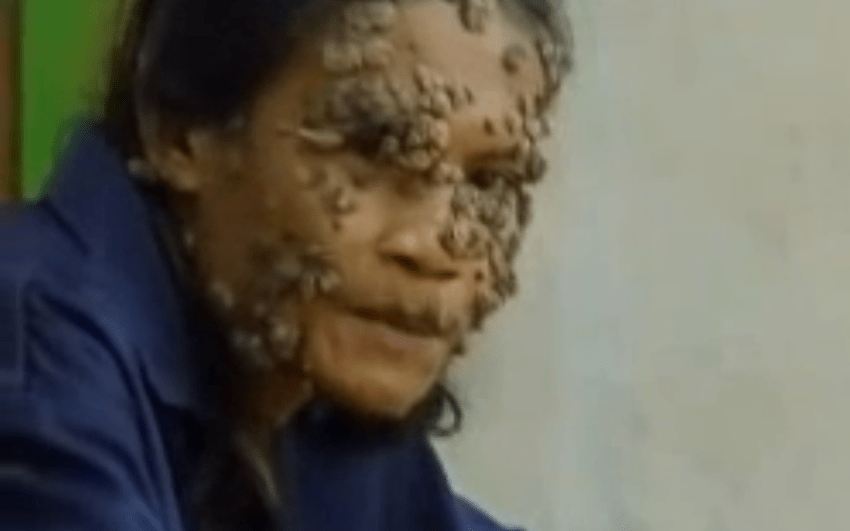 16 Terrifying, Bizarre Medical Conditions You’ve Never Heard Of (That You Might End Up With)