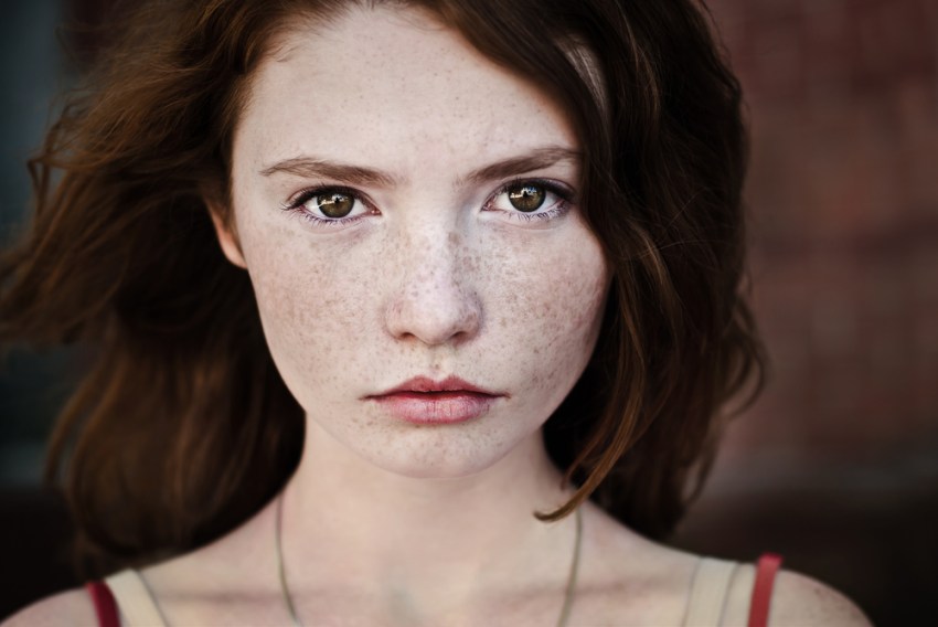 7 Struggles Of Having A Lot Of Freckles