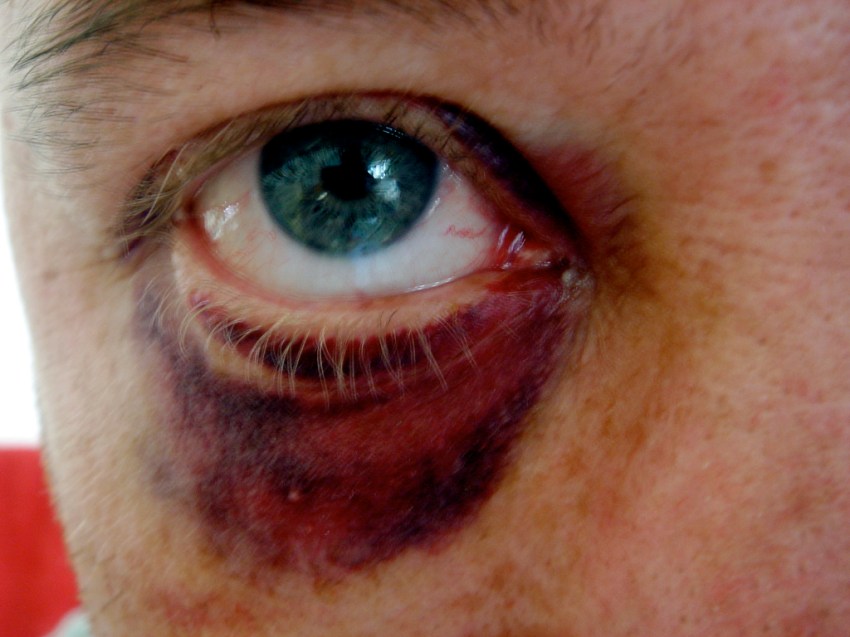 When A Woman Hits A Man It’s Justified