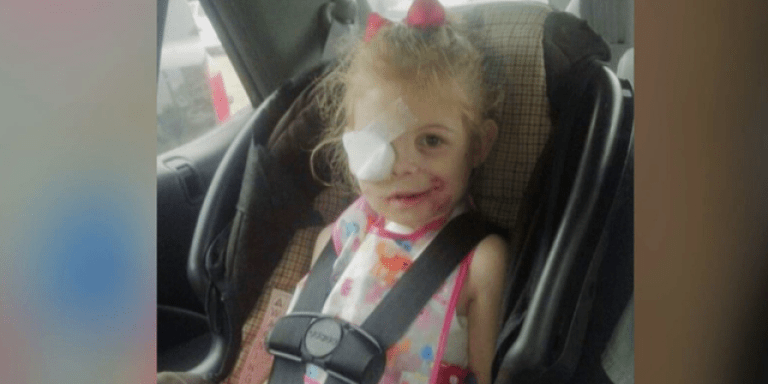 3-Year-Old Girl Asked To Leave KFC Because Her Facial Scars Were “Disrupting Customers”