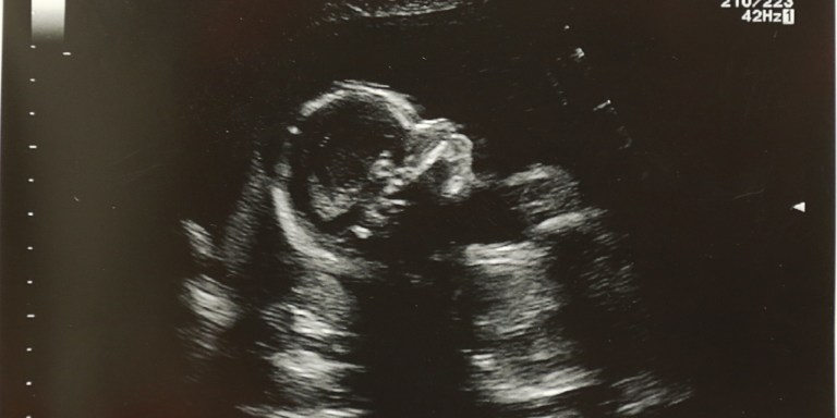 My Wife And I Were Really Excited To Become Parents — That Is, Until We Saw The Ultrasound
