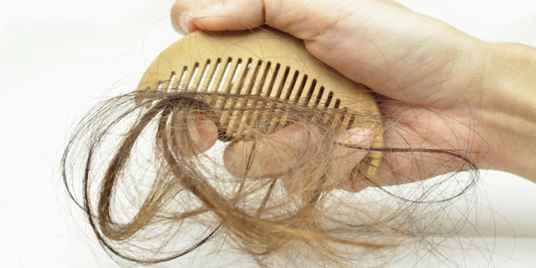 Living With Alopecia: It Is More Than Just Hair Loss