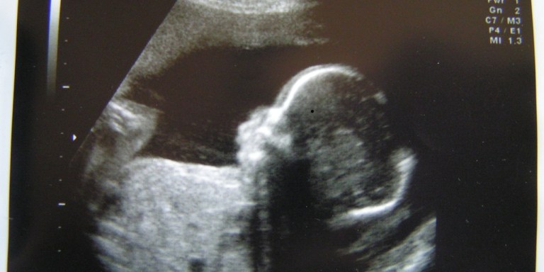 11 Surprising Things You Probably Didn’t Know About Abortions