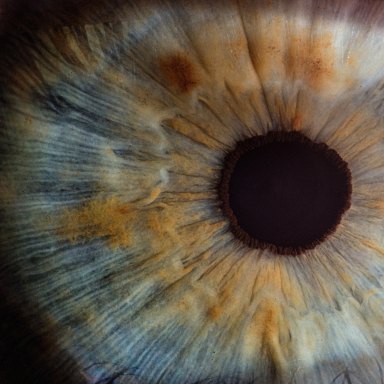 You Might Think Twice About Getting Laser Eye Surgery After You Read This Story