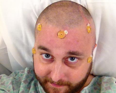 Man With Skin Cancer Chronicles His Journey In This Heart-Wrenching Photo Journal
