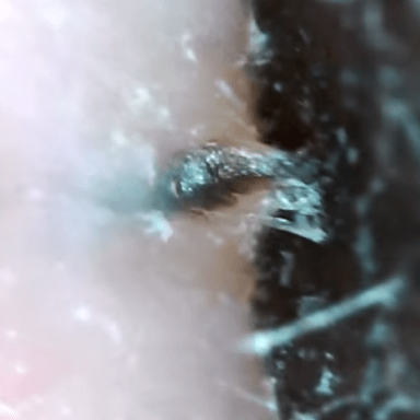 This Disgusting Video Of A Pore Strip Reveals Something Dark And Gooey Inside