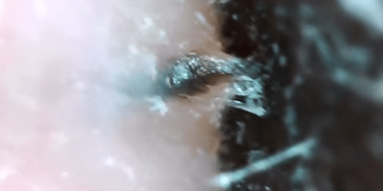 This Disgusting Video Of A Pore Strip Reveals Something Dark And Gooey Inside
