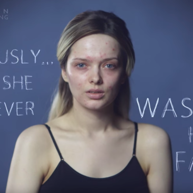 Watch Em Ford’s Inspirational Response To The Vicious Comments About Her Acne