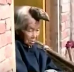 Chinese Woman Can’t Decide If She Wants Unicorn Horn Removed From Her Head