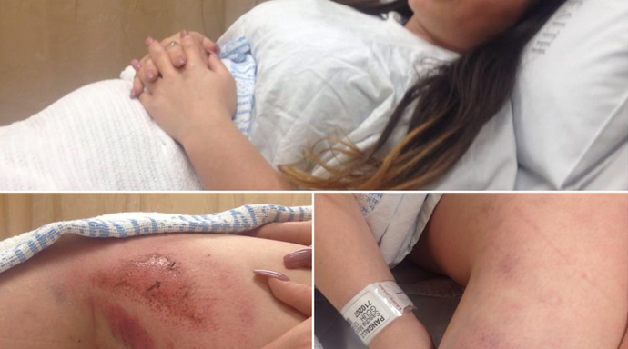 California Woman Claims That She Was Attacked And Run Over By Abusive Uber Driver