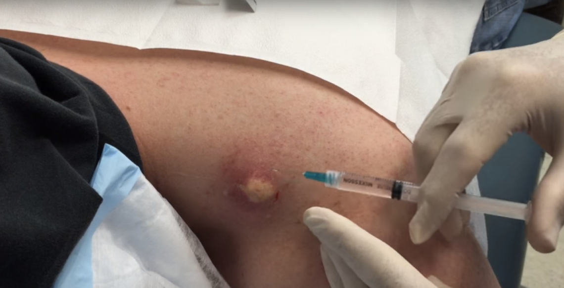 Youtube / John Gilmore, MD