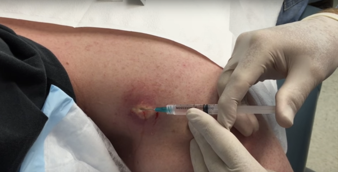 Youtube / John Gilmore, MD