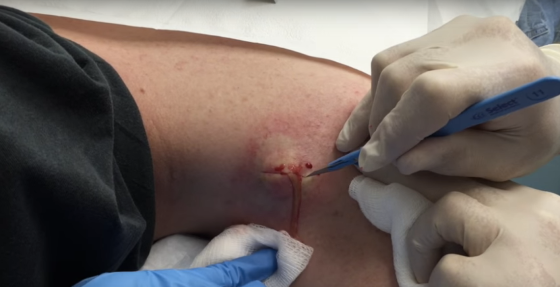 Youtube / John Gilmore, MD
