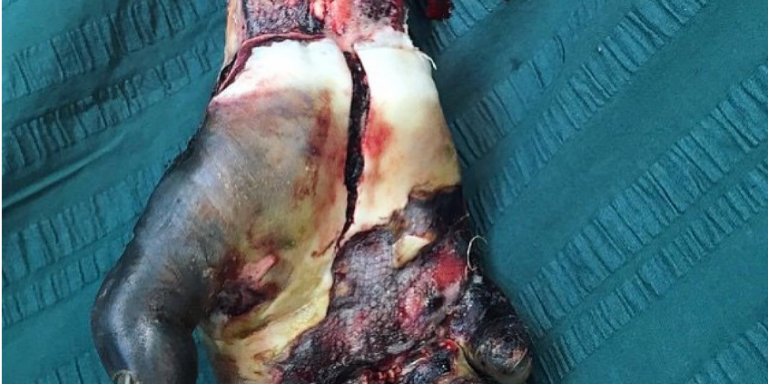 50 Insanely Disturbing Photos Of The Human Body From Actual Medical Procedures