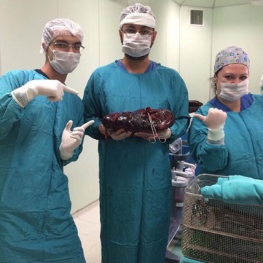 31 Incredibly Gruesome Photos Of The Human Body During Actual Surgeries