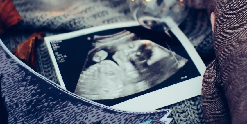 The Doctors Are Disturbed By The Ultrasound Of My Unborn Baby 