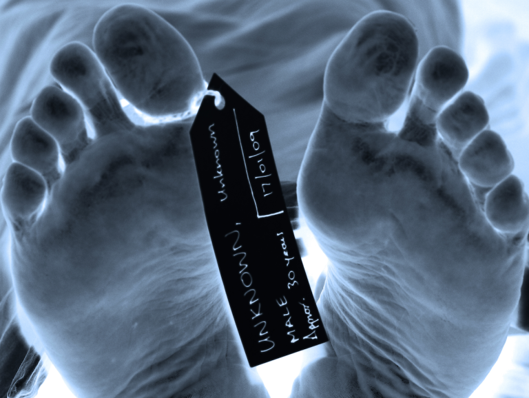 Tales From The Morgue: 25 Horrifying And Grisly True Stories About Handling Dead Bodies
