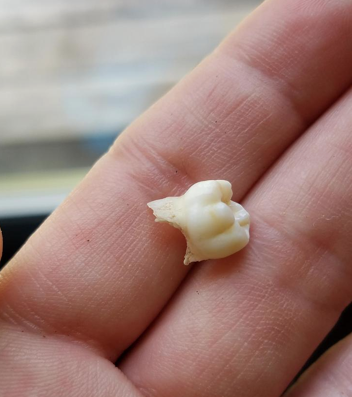 This Woman Didn't Lock Her Doors Until She Was Cleaning Her Bedroom And Found Someone's Tooth