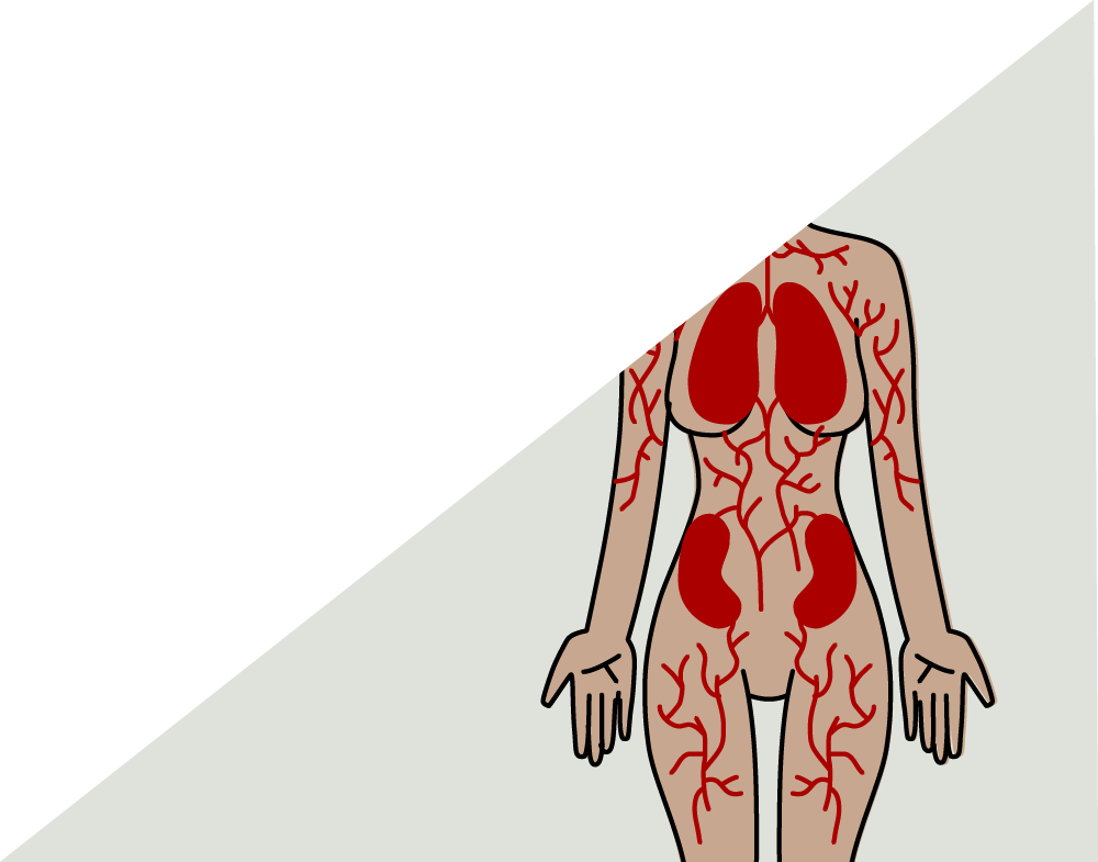 Other Immune Disorders