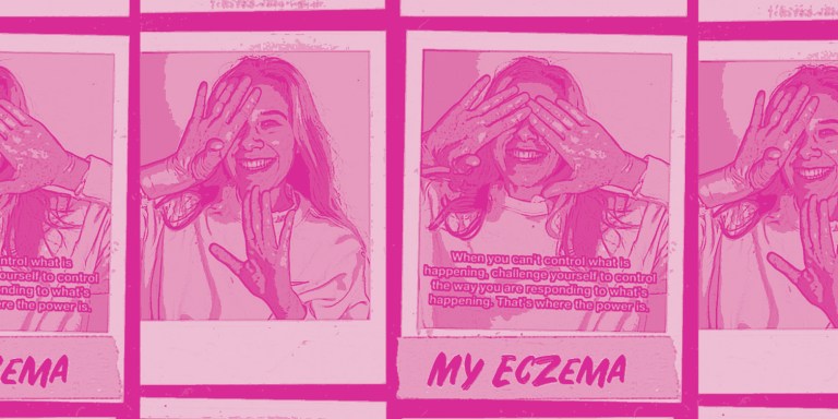 Want To Know Why I Show Off My Eczema So Much?